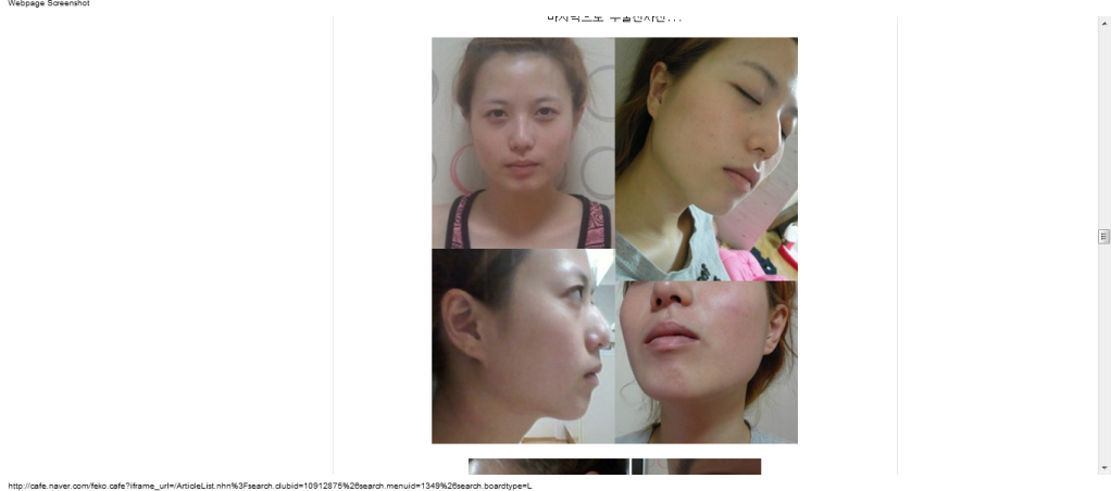 Forum Image: http://i1256.photobucket.com/albums/ii488/khat311/FoxBeautyCafeplasticsurgerycosmeticskineventsdirectionscheheomdanNaverCafe-090151.png