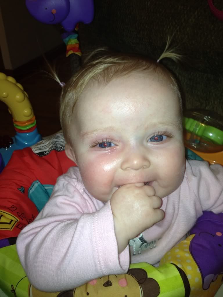 Baby allergic to pears ( BabyCenter