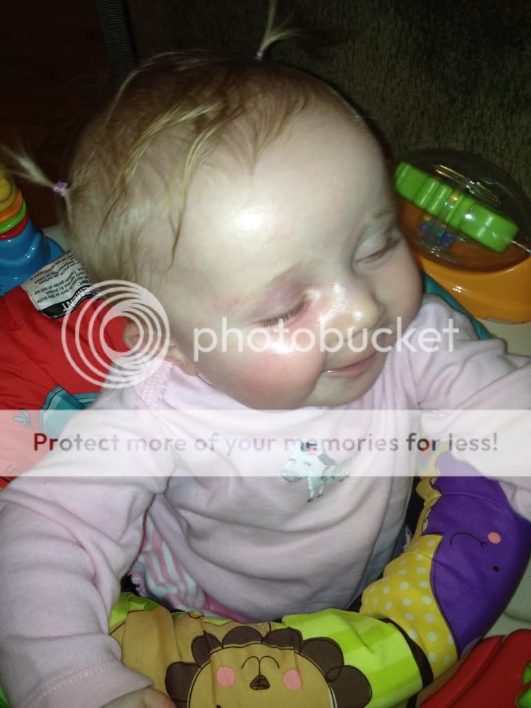 Baby allergic to pears ( BabyCenter